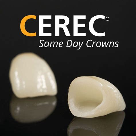 Same Day Crowns by CEREC .
